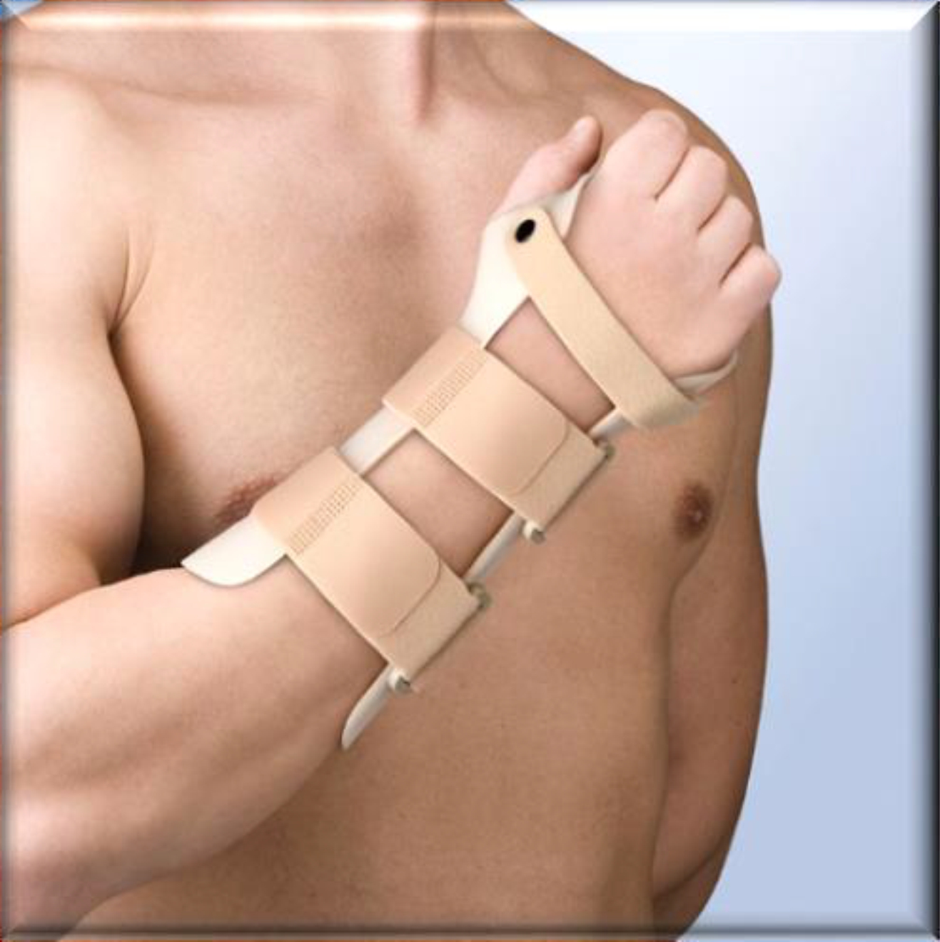 Wrist Immobilisation Splint (In Dorsiflexion 35 degrees- 40 degrees) Right Size 2